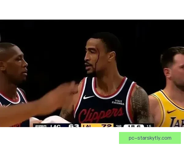 伦纳德低迷三配角齐爆发柯林斯